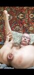 Serzh Kinky shows prolapse