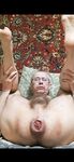 Serzh Kinky shows prolapse
